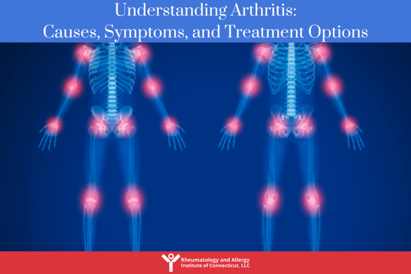 Understanding Arthritis Causes, Symptoms, and Treatment Options
