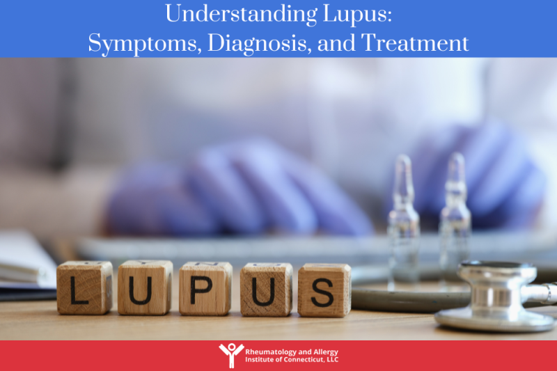 Understanding Lupus Symptoms, Diagnosis, and Treatment